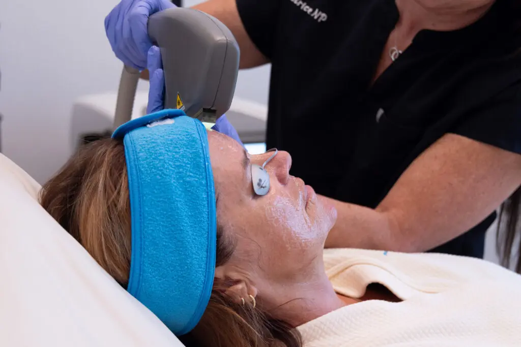 IPL - Serenity MedAesthetics Spa in Youngsville, LA