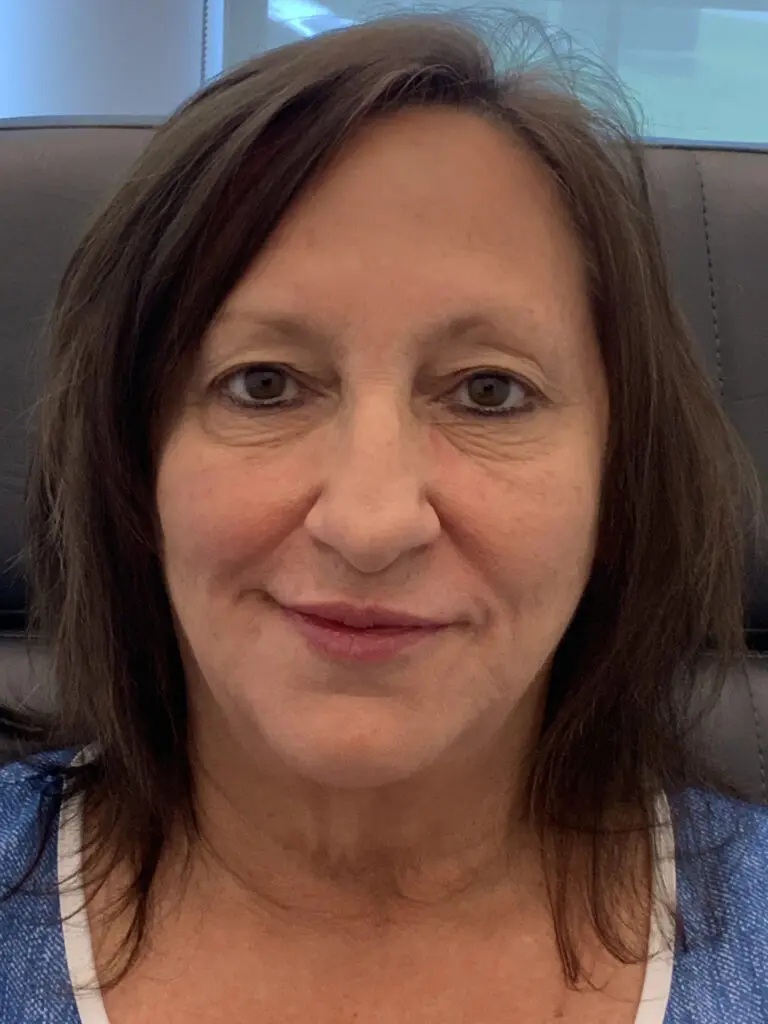 Facial Rejuvenation - after treatment