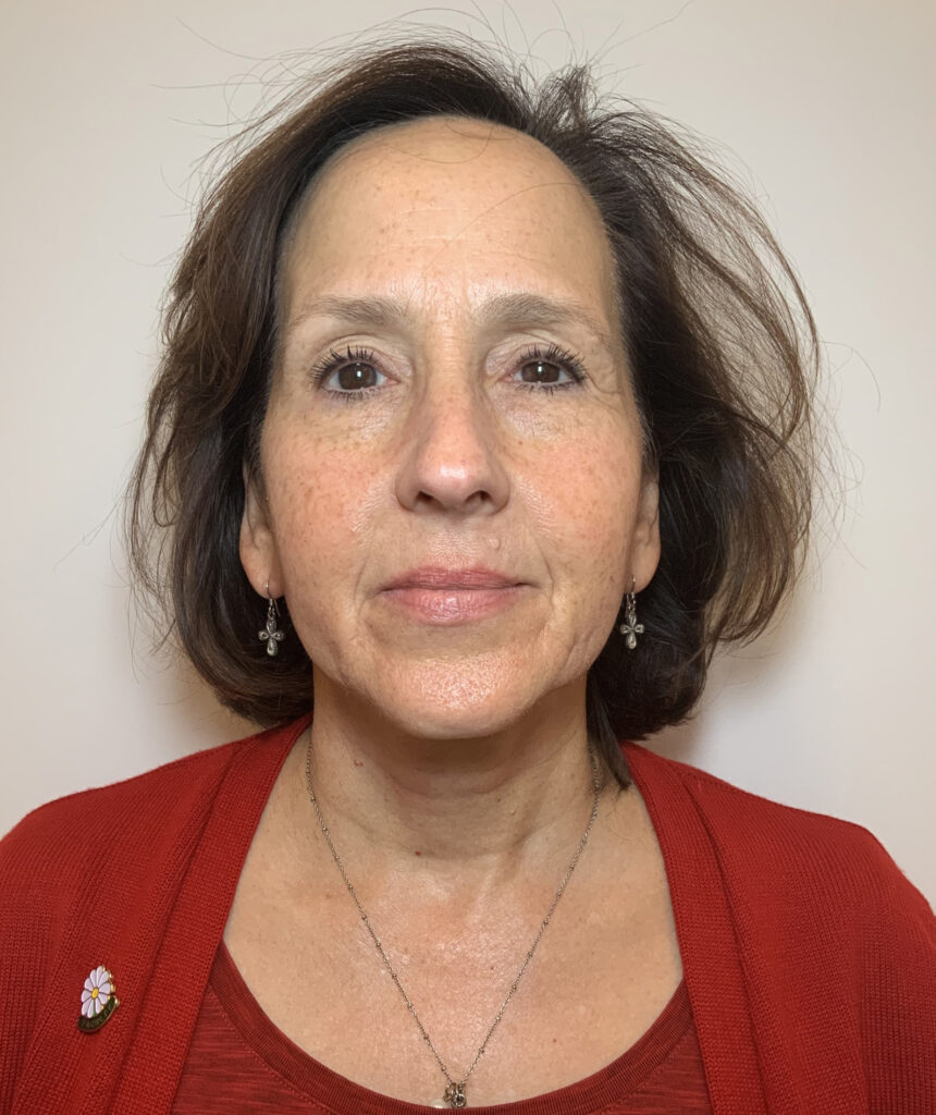 Laser Genesis - after treatment